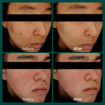 Picture of Muama RETINOL HEARTLEAF REPAIR AMPOULE