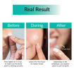 Picture of SOME BY MI CLEAR SPOT PATCH