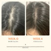 Picture of GROW:TURN EXOSOME TURN BRUSH AMPOULE