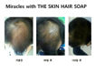 Picture of THE SKIN HAIR SOAP